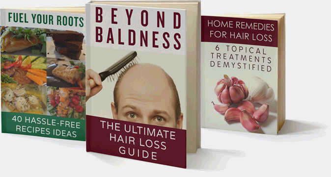 Hair Loss Recovery